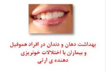 تصویر از بهداشت دهان و دندان در افراد هموفیل و بیماران با اختلالات خونریزی دهنده ی ارثی